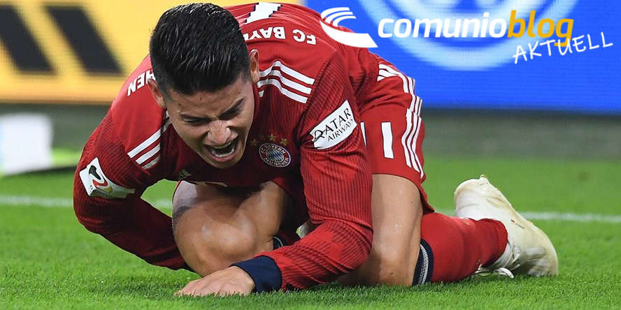 Comunio aktuell: Mehrere Wochen Pause für James!
